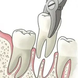 best dentist in miami,porcelain veneers miami,Botox miami,root canal cost miami,sinus lift miami,best veneers miami,best dentist south florida,best cosmetic dentist miami,best dental care miami,sage dental